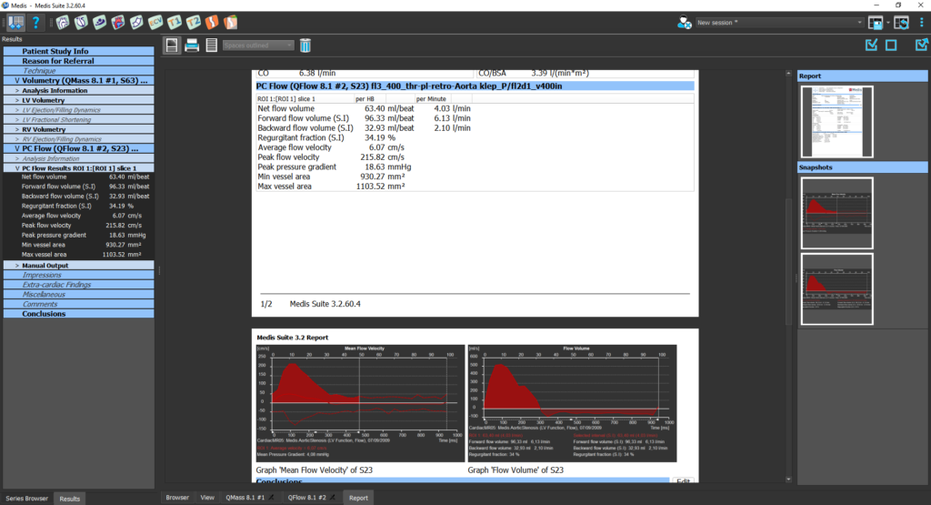2D Flow Module 4