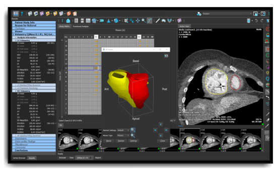 Medis Suite CT product screen