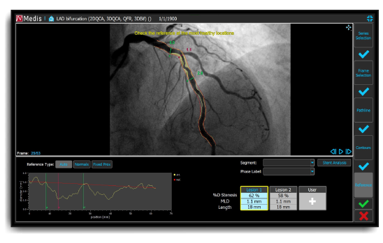 Medis suite XA product screen